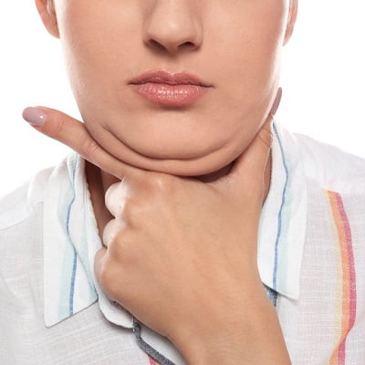 double chin removal in Islamabad, Rawalpindi & Pakistan