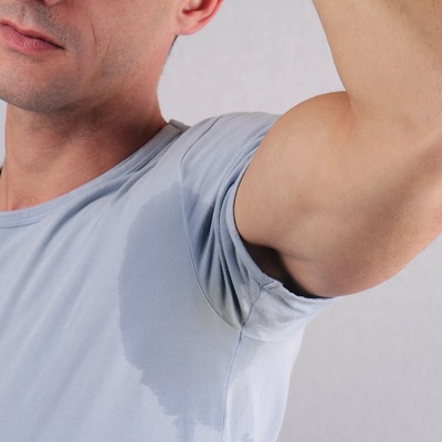 Excessive Sweating Hyperhidrosis in Islamabad