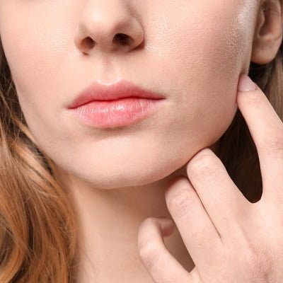 Buccal Fat Removal in Islamabad, Rawalpindi, and Pakistan.