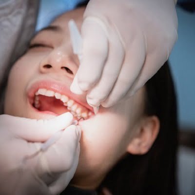 wisdom tooth extraction in islamabad