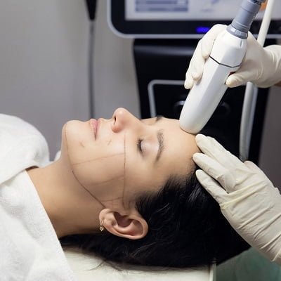 Hifu treatment for facelift in Islamabad