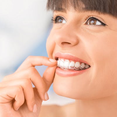 Invisalign Treatment in Islamabad