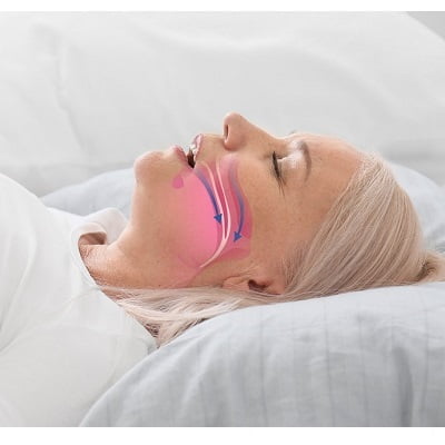 Snoring Treatment in Islamabad