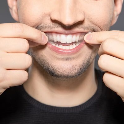 Teeth Whitening Strips