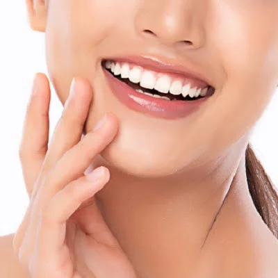 Laser Teeth Whitening in Islamabad Pakistan - RCS