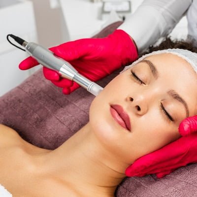 Nano needling and Micro-needling