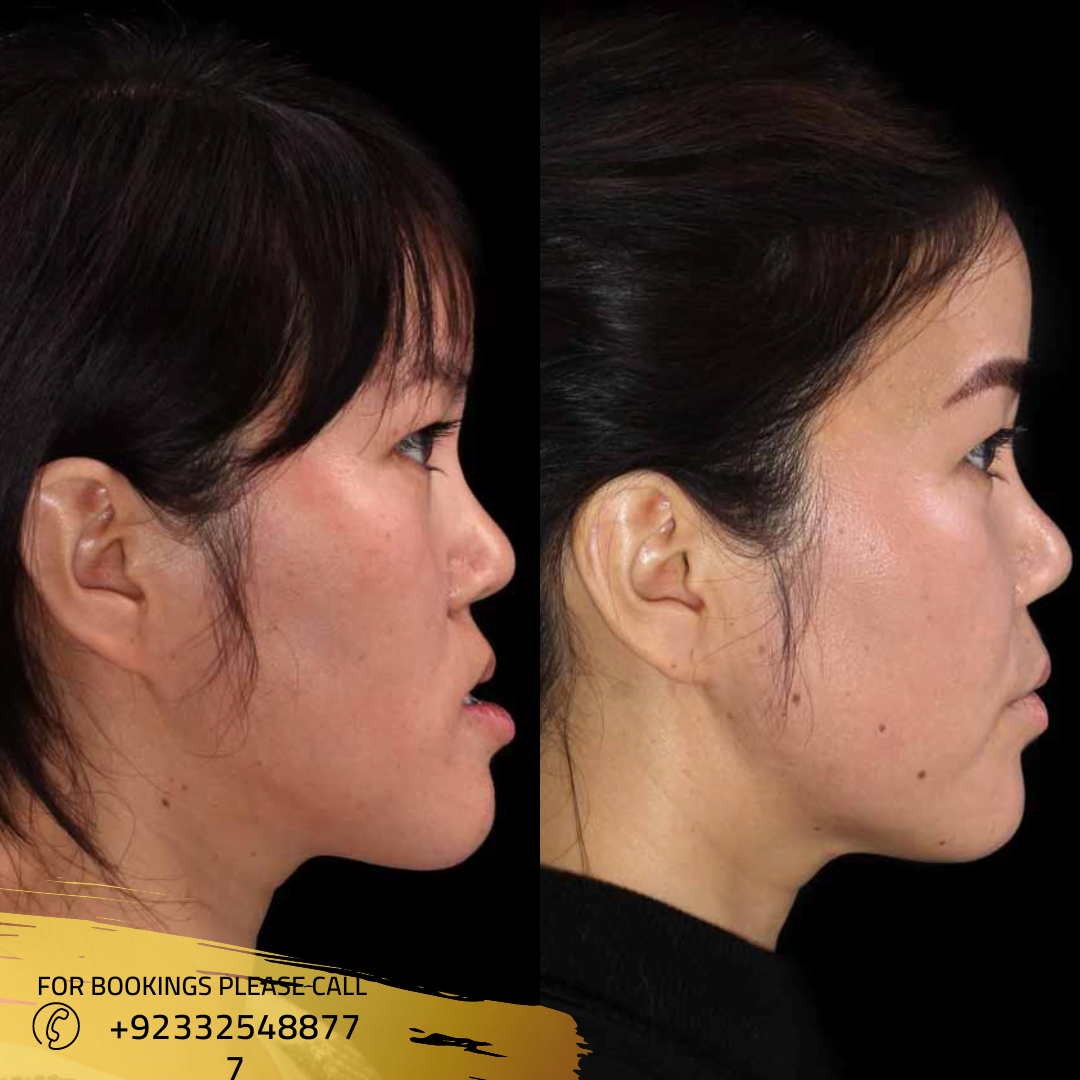 jaw treatment in Islamabad