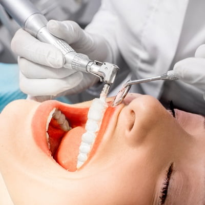 Scaling, polishing and teeth whitening