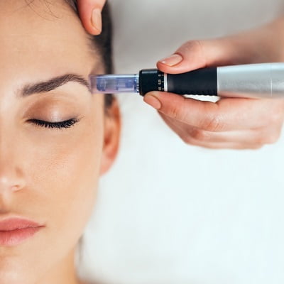 Benefits of microneedling