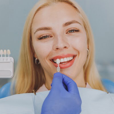 dental veneers