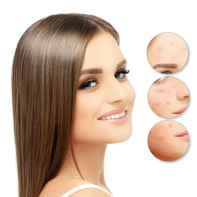 dermabrasion for acne scars in islamabad
