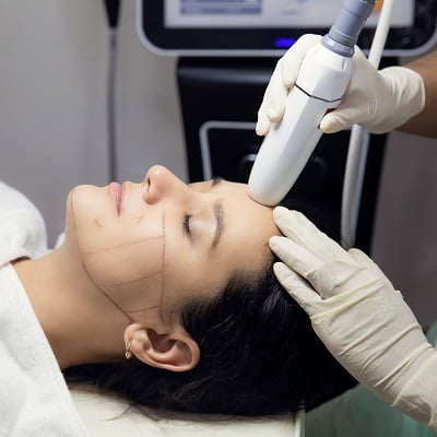 hifu treatments