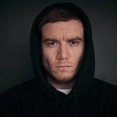 melasma in men