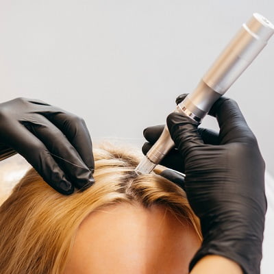 cost of prp hair treatment