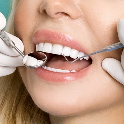 teeth whitening