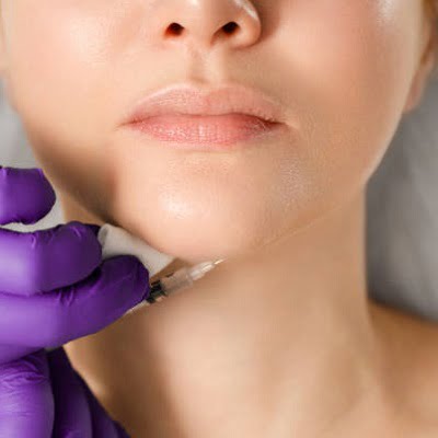 jawline fillers