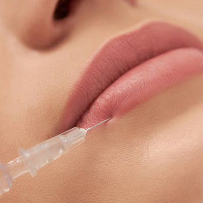 lip fillers