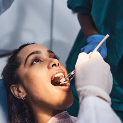 what is the expected life of root canal treatment