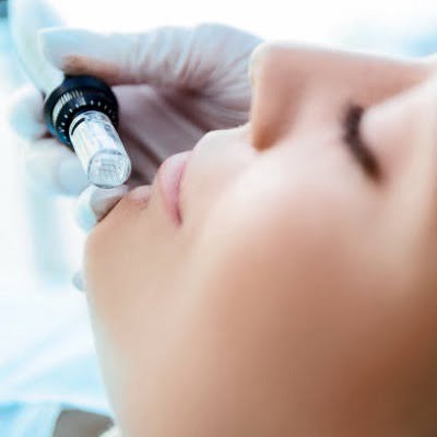 Do you bleed after microneedling?