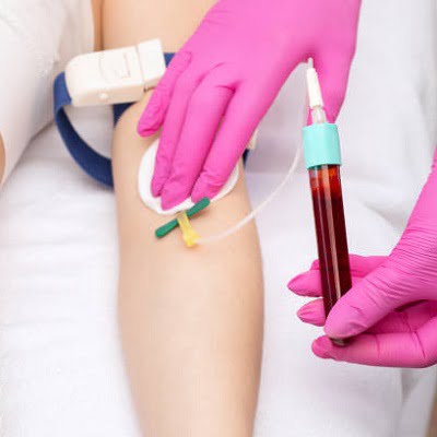 filler injections with PRP Islamabad, Rawalpindi & Pakistan