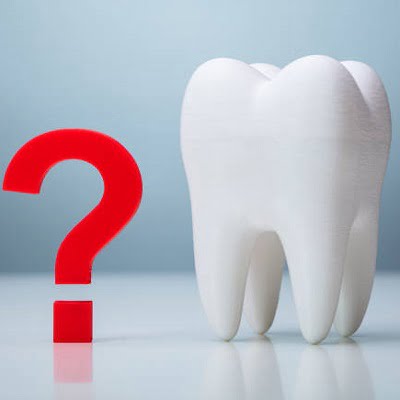 Dental Implant FAQs