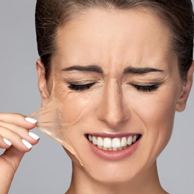 Cost of Chemical Peel Treatment in Islamabad