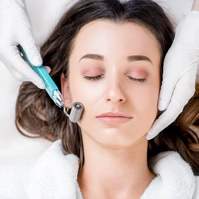 Can A 16-Year-Old Get Microneedling Treatment