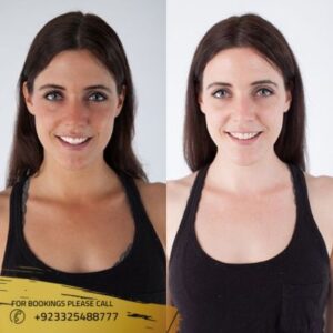 skin whitening treatment results