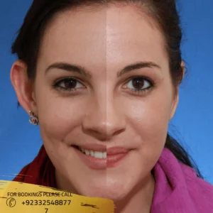 before after of ear surgery in islamabad