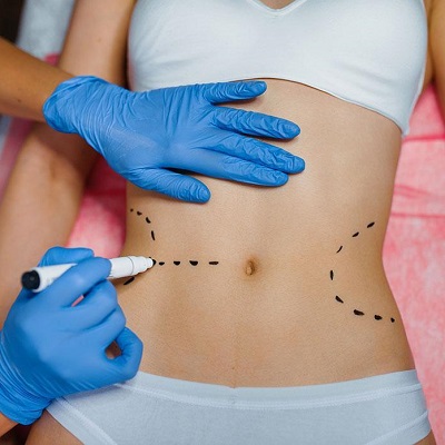 How Long Is Bed Rest After Liposuction