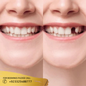 best dental clinic in islamabad