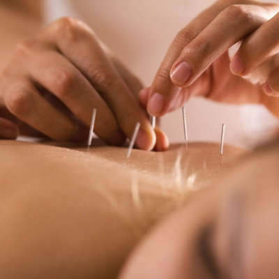 Can Nerve pain be treated with Acupuncture Treatment?