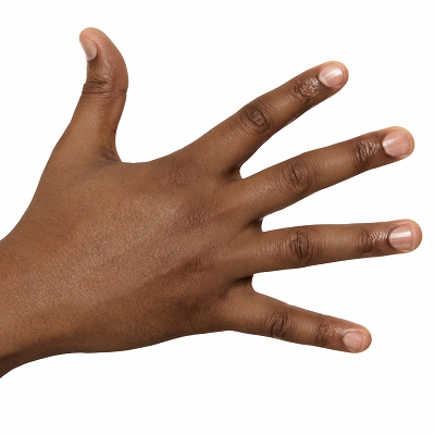 How to Fix Hyperpigmentation on Hands?