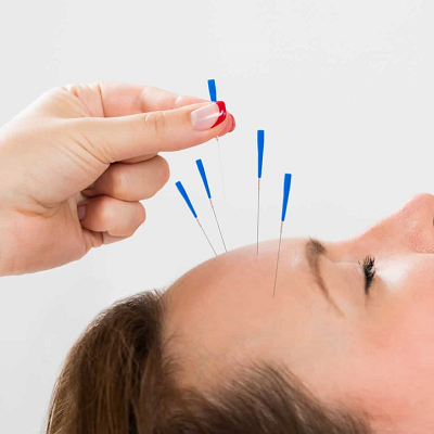 Is electroacupuncture good for mental health?