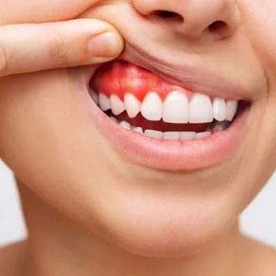 Why do I still feel sensation in my root-treated tooth?