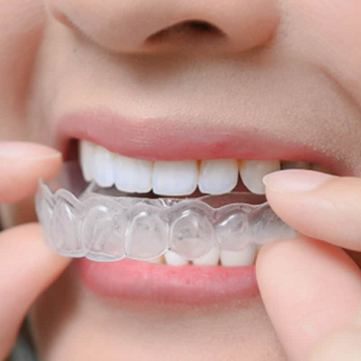 Best Invisalign braces in Islamabad