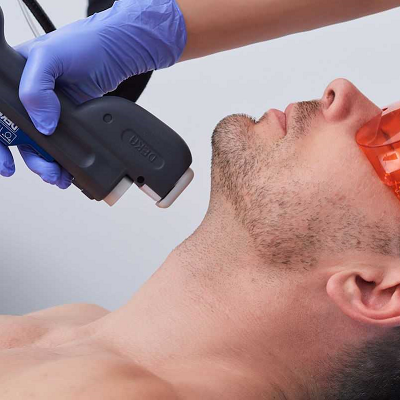 Beard Line Laser Cost in Islamabad Pakistan