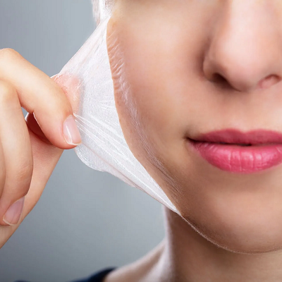 Can Chemical Peels Remove Sun Damage or Pigmentation?