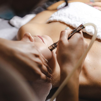 Does laser work for PCOS chin hair?