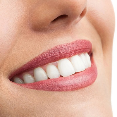 How do Dental Crowns and Bridges work