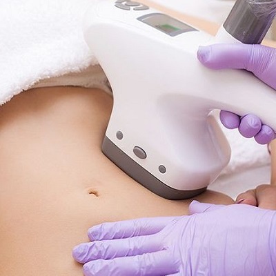 How many sessions are typically needed for Cellulite removal?