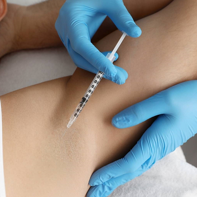 Is hyperhidrosis treatment permanent?