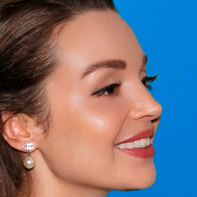 Is it normal to bleed after jaw surgery?