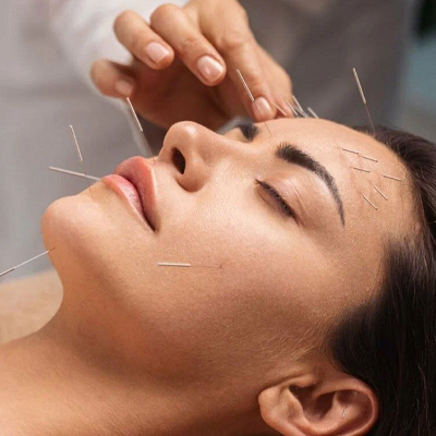 Does Accupuncture Treatment Gives Permanent Results or Not