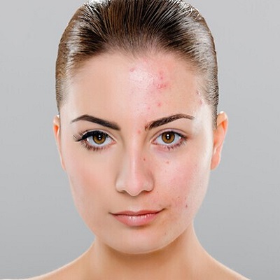 How to make scars heal faster on the face
