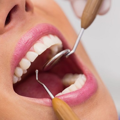 What Options Do I Have For Root Canal Treatment?