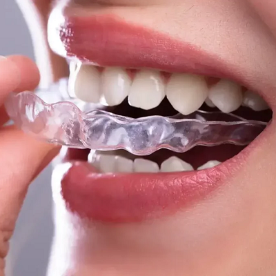Which Clinic is Best for Teeth Aligners in Islamabad