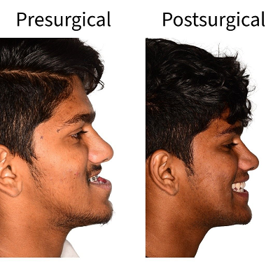 Best Jaw Surgery Clinic Near Me