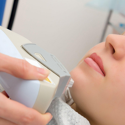 Is Laser Hair Removal Suitable For PCOS?