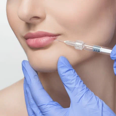 What are the best fillers for the face in Islamabad